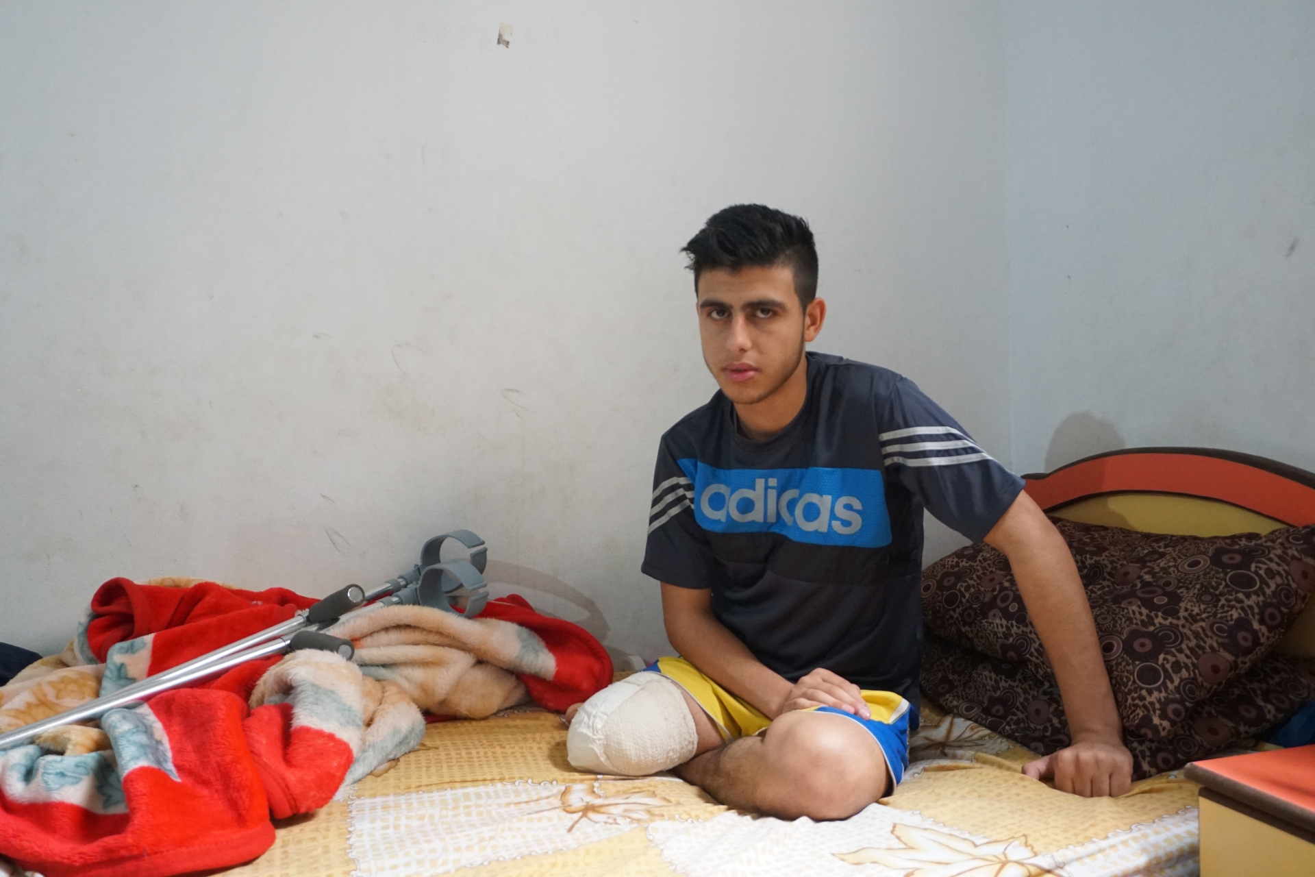 Mohammed al-Ajouri. Right leg amputated after he was shot and injured by Israeli forces during a demonstration in Gaza on 30 March.