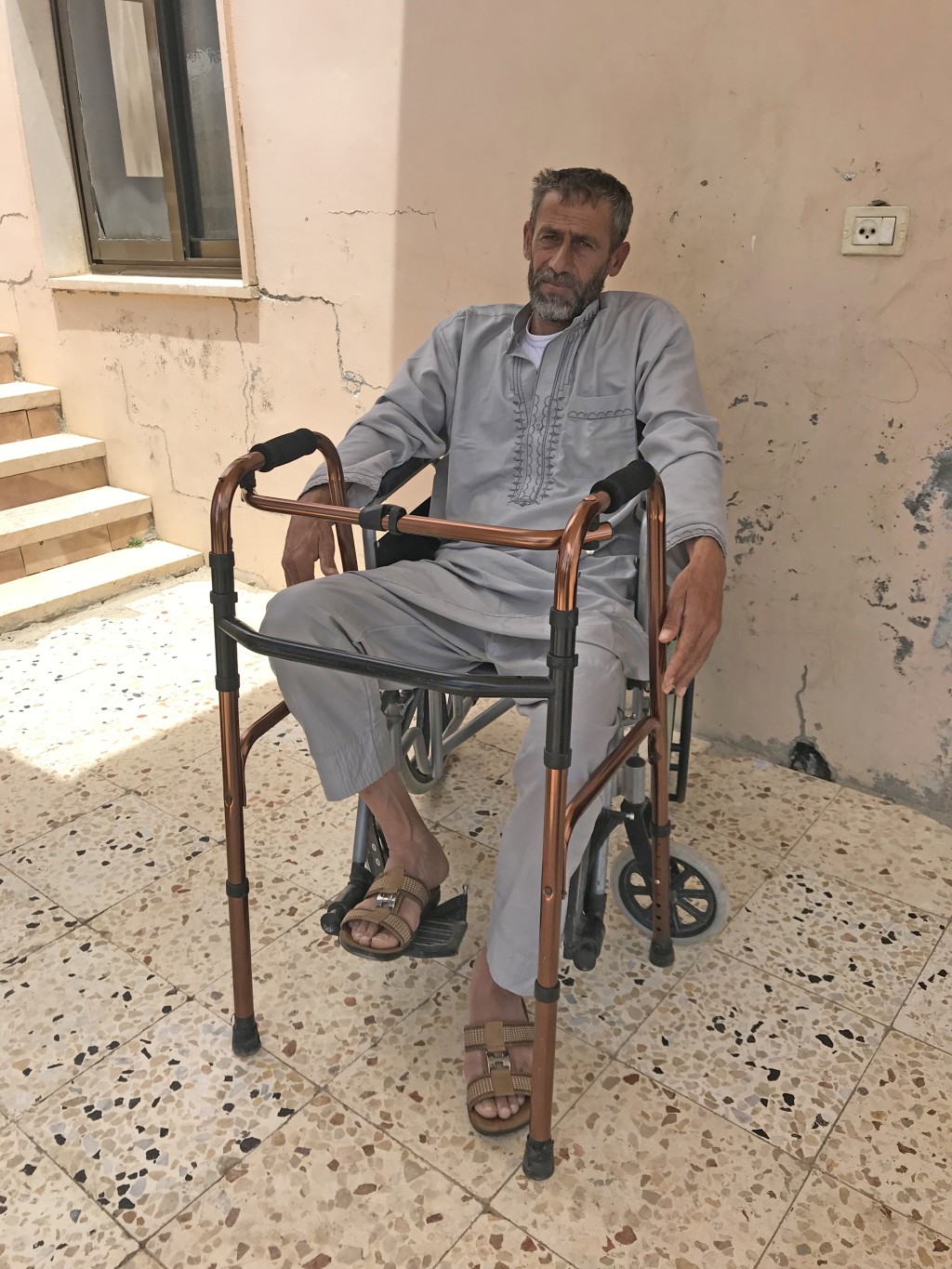 Jum’a Ar Raba’ai at his home following his injury, March 2018. © Photo by OCHA