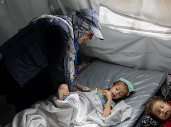 A 7-year-old girl with severe acute malnutrition and dehydration was transferred from Kamal Adwan hospital in Gaza to a field hospital in the south. Photo by WHO