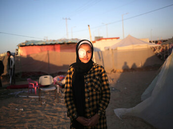 Abrar, 15-year-old, who was hit by shrapnel. “When my house was bombed and destroyed, two of my brothers were killed, and a third one was injured. Some shrapnel hit my right eye, causing weak eyesight and constant tears.” Photo by UNICEF