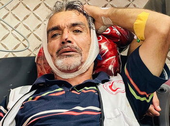 A volunteer with the Palestine Red Crescent Society receives medical treatment after being injured by Israeli settlers who attacked olive harvesters in Beita, Nablus, 8 November 2025. Photo by journalist Abdullah Bahesh
