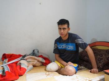 محمد العجوري، بُترت رجله اليمنى بعدما أطلقت القوات الإسرائيلية النار عليه وأصابته بجروح خلال مظاهرة شهدتها غزة في يوم 30 آذار/مارس  © - مكتب الأمم المتحدة لتنسيق الشؤون الإنسانية