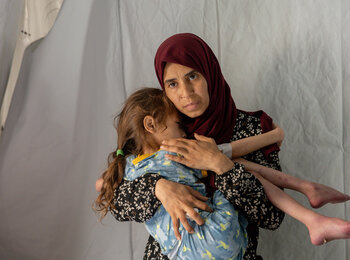 Jana (7) has received treatment at a WHO-supported stabilization centre after being diagnosed with severe acute malnutrition and dehydration. Photo by WHO 