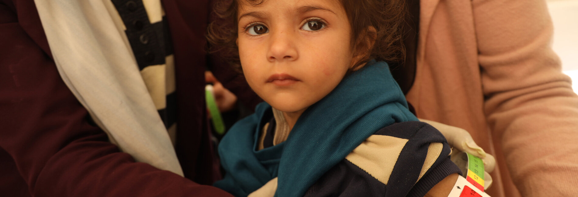 A two-year-old girl getting her middle-upper-arm-circumference (MUAC) measured. Her MUAC reads less than 10, indicating severe acute malnutrition, drastic weight loss, and muscle atrophy. Photo by UNICEF/ Eyad El Baba