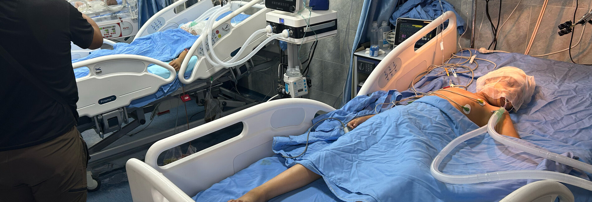 A child receives treatment at Kamal Adwan Hospital’s Intensive Care Unit in North Gaza. Photo by OCHA